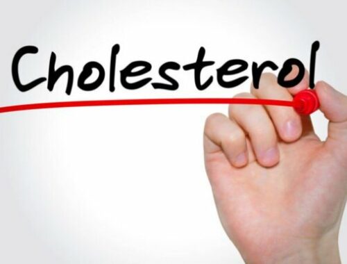 Cholesterol là gì