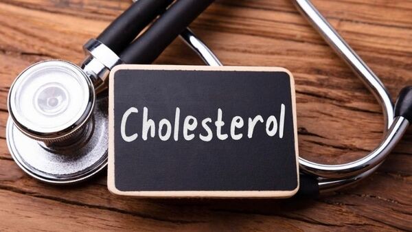 Cholesterol